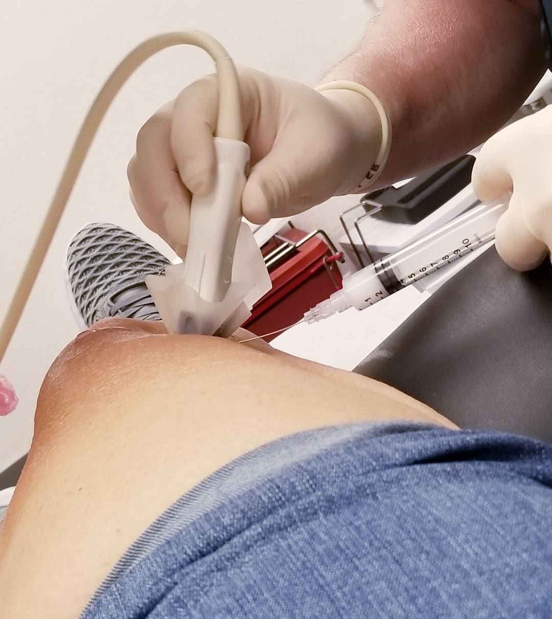 Infiltraciones ecoguiadas en Barcelona | Clínica Albareda, image size:1080x1210