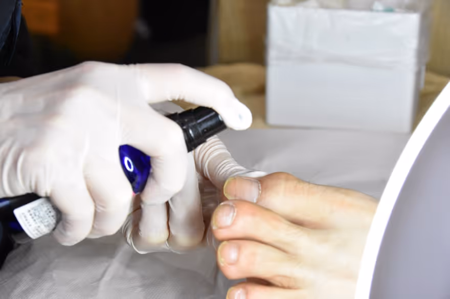 巻き爪治療施術の様子