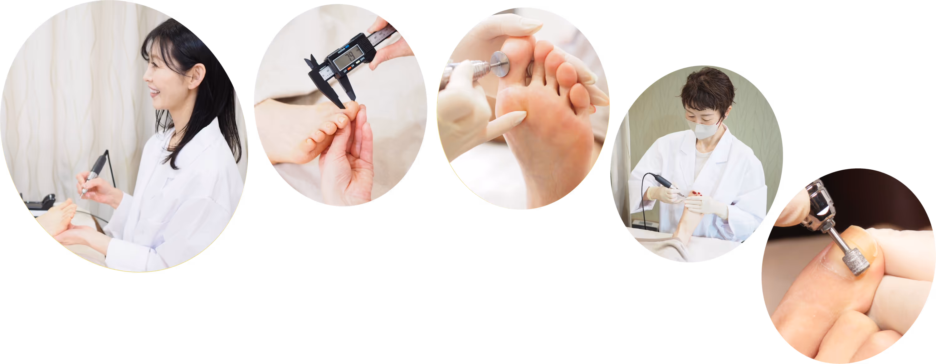 巻き爪研究所の施術者や治療の様子