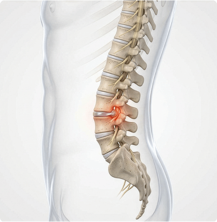 consulta traumatológica en Lima evaluación de rodilla