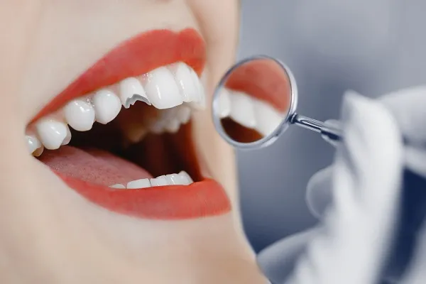 Emergency steps for a chipped or knocked-out tooth