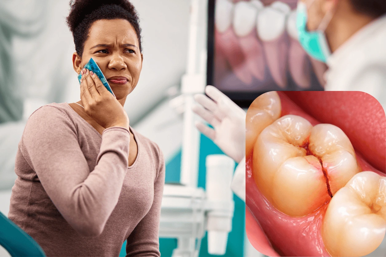 My Tooth Cracked? Learn the signs, causes, and treatment options for cracked teeth to protect your smile.