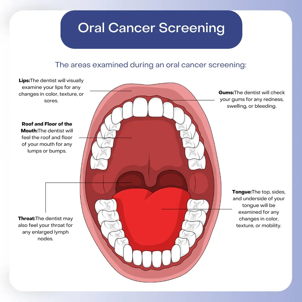 Symptoms of oral cancer, including mouth lesions and discoloration