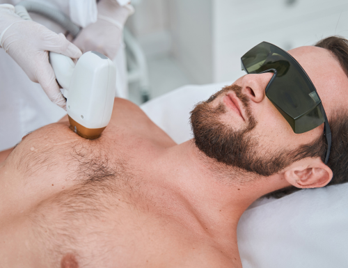 man hair laser removal with Alma Soprano Ice yorkville toronto