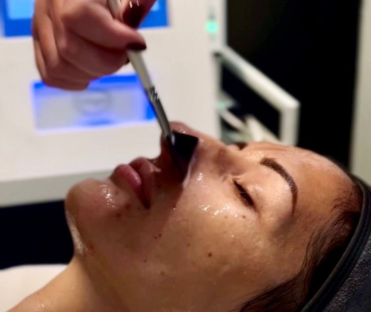 iS Clinical Fire & Ice Peel
