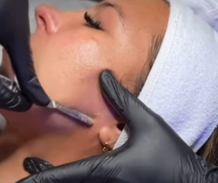 dermaplaning-toronto