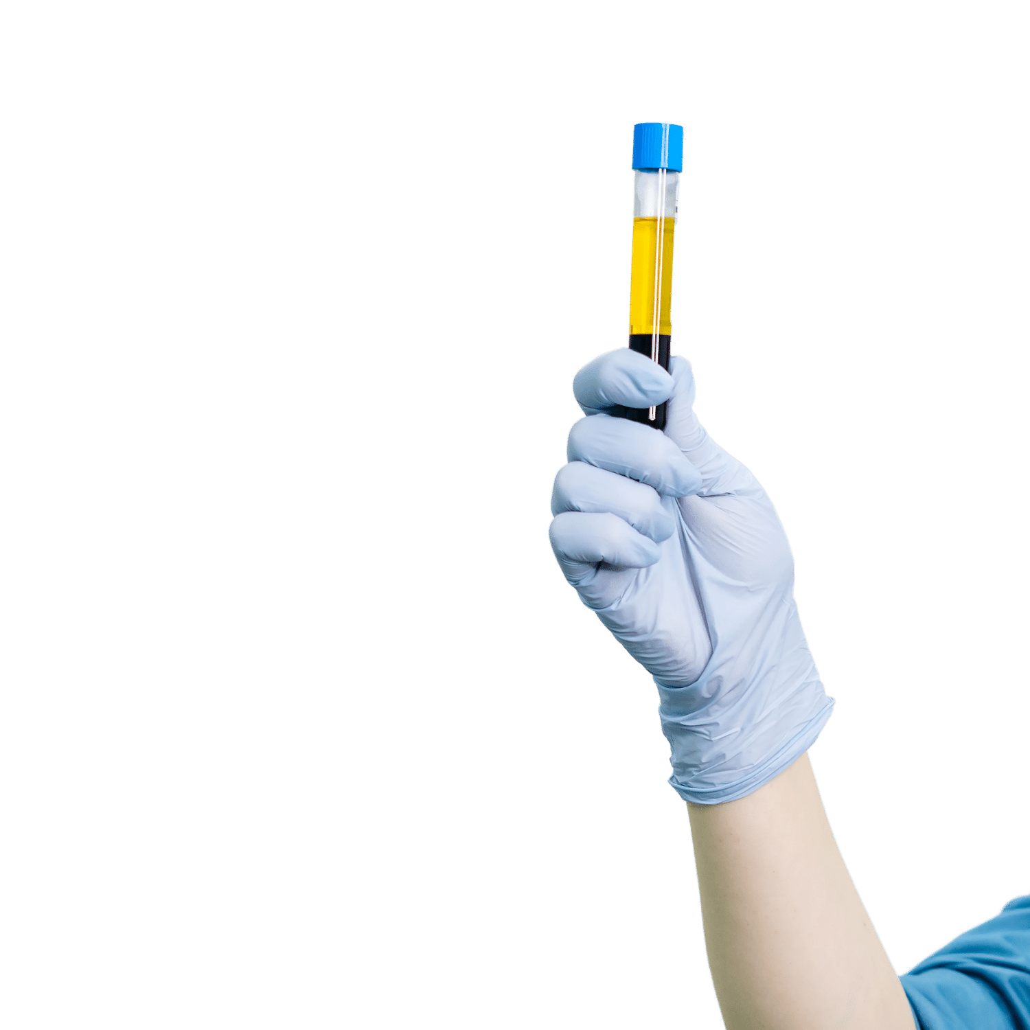 Gloved hand holding a tube of platelet-rich plasma