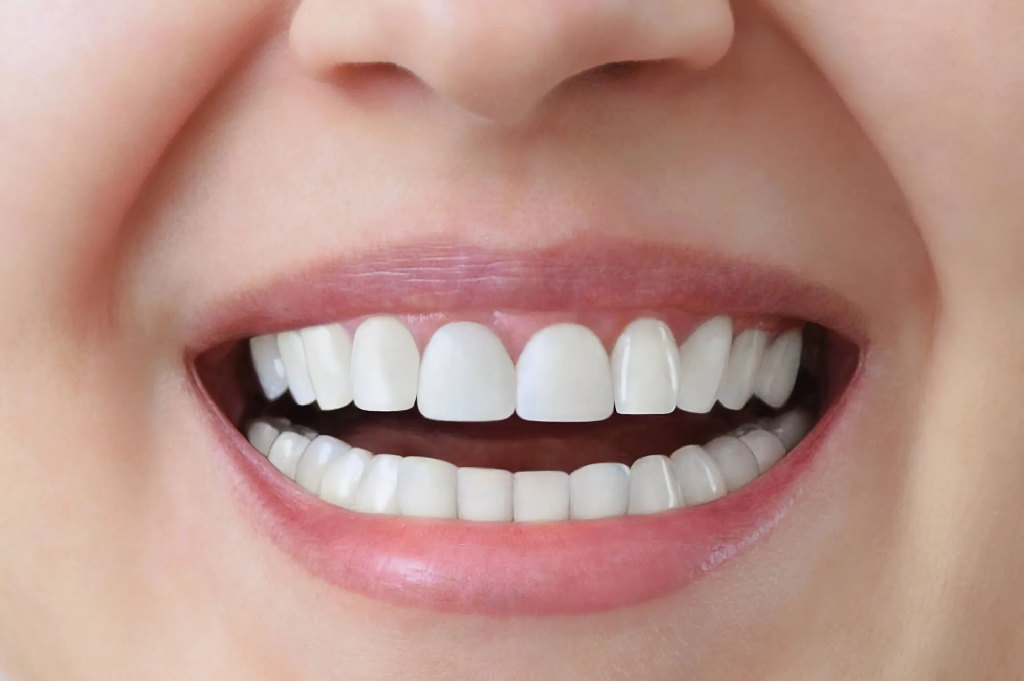 smiling wearing seamless Crowns Issaquah