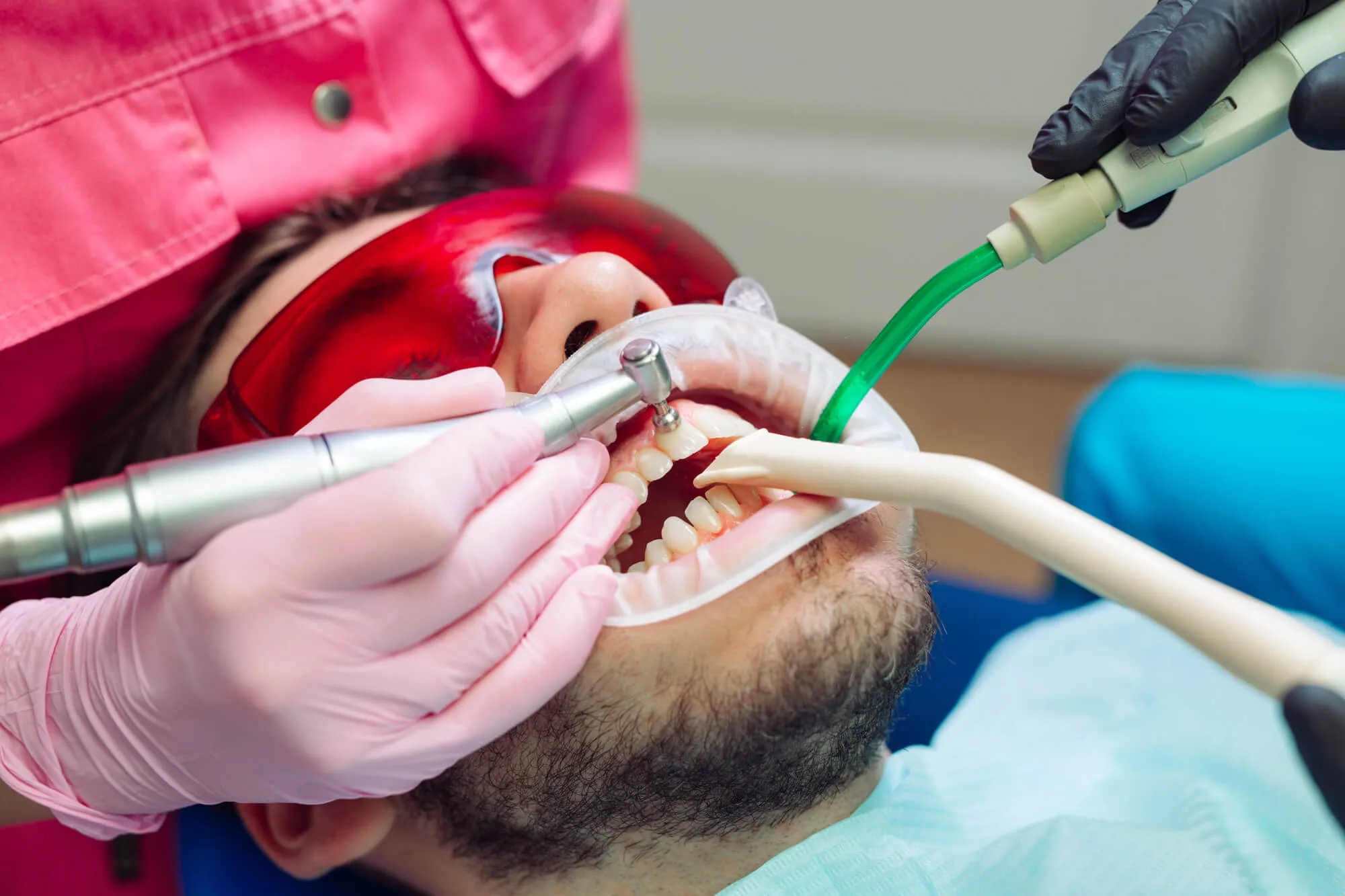 Teeth Cleaning Issaquah