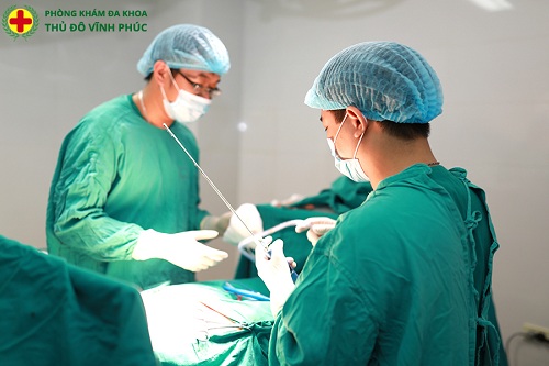 Kỹ thuật GPH Châu Âu