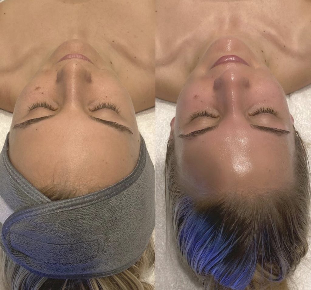 Augenbrauen Permanent