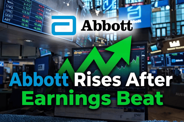 Abbott shares draw attention after revenue rose 13% and full-year adjusted EPS guidance was raised.