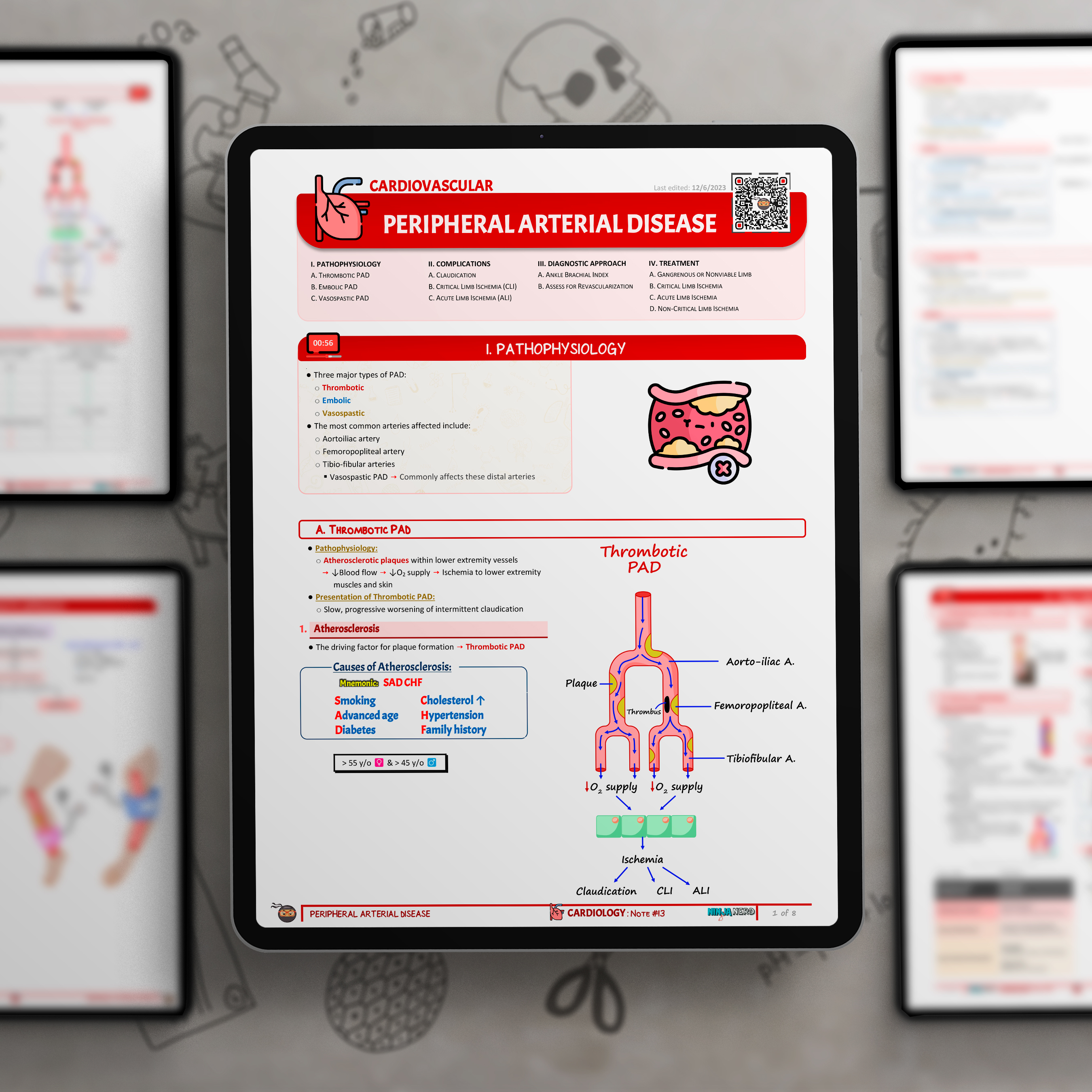 Peripheral Arterial Disease