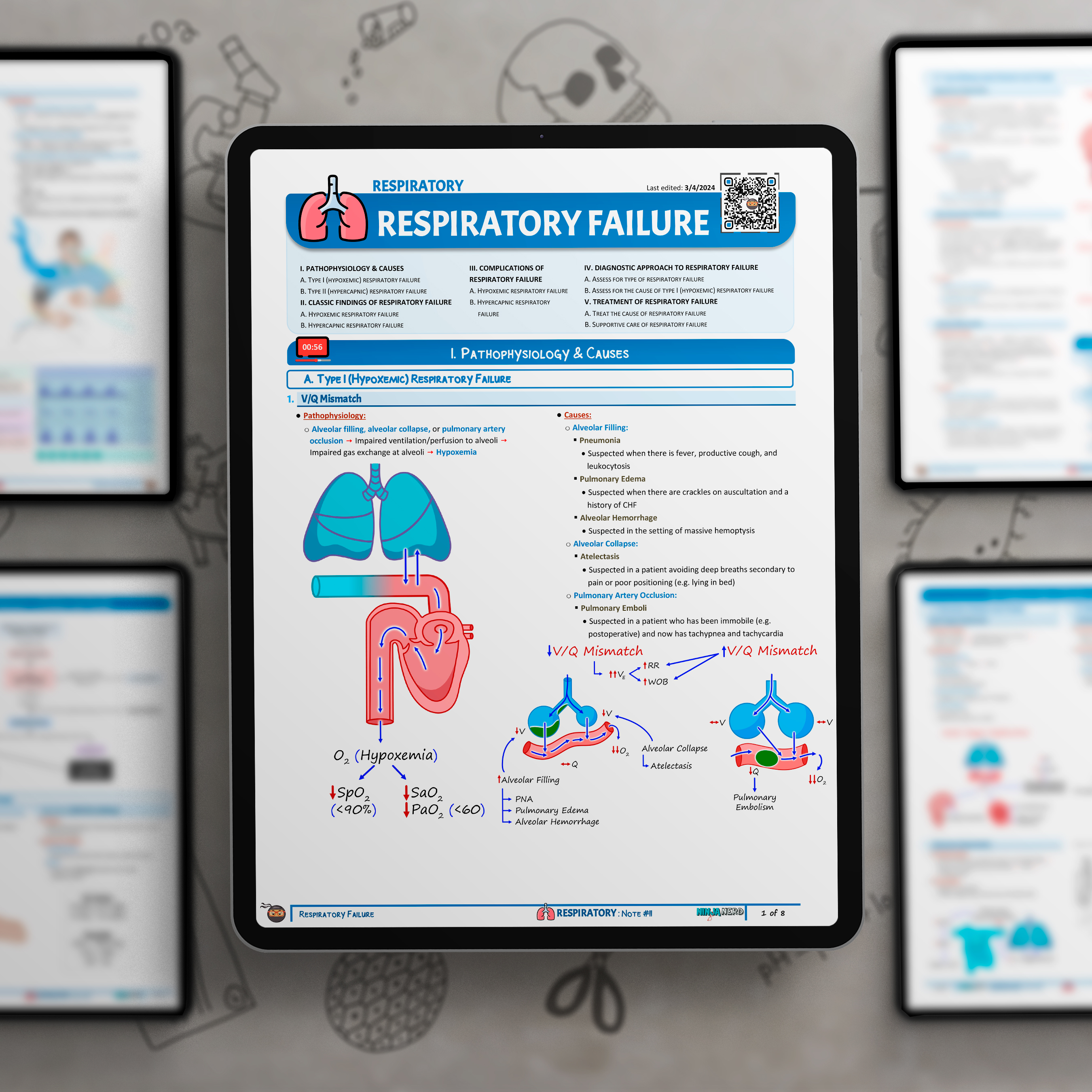 Respiratory Failure