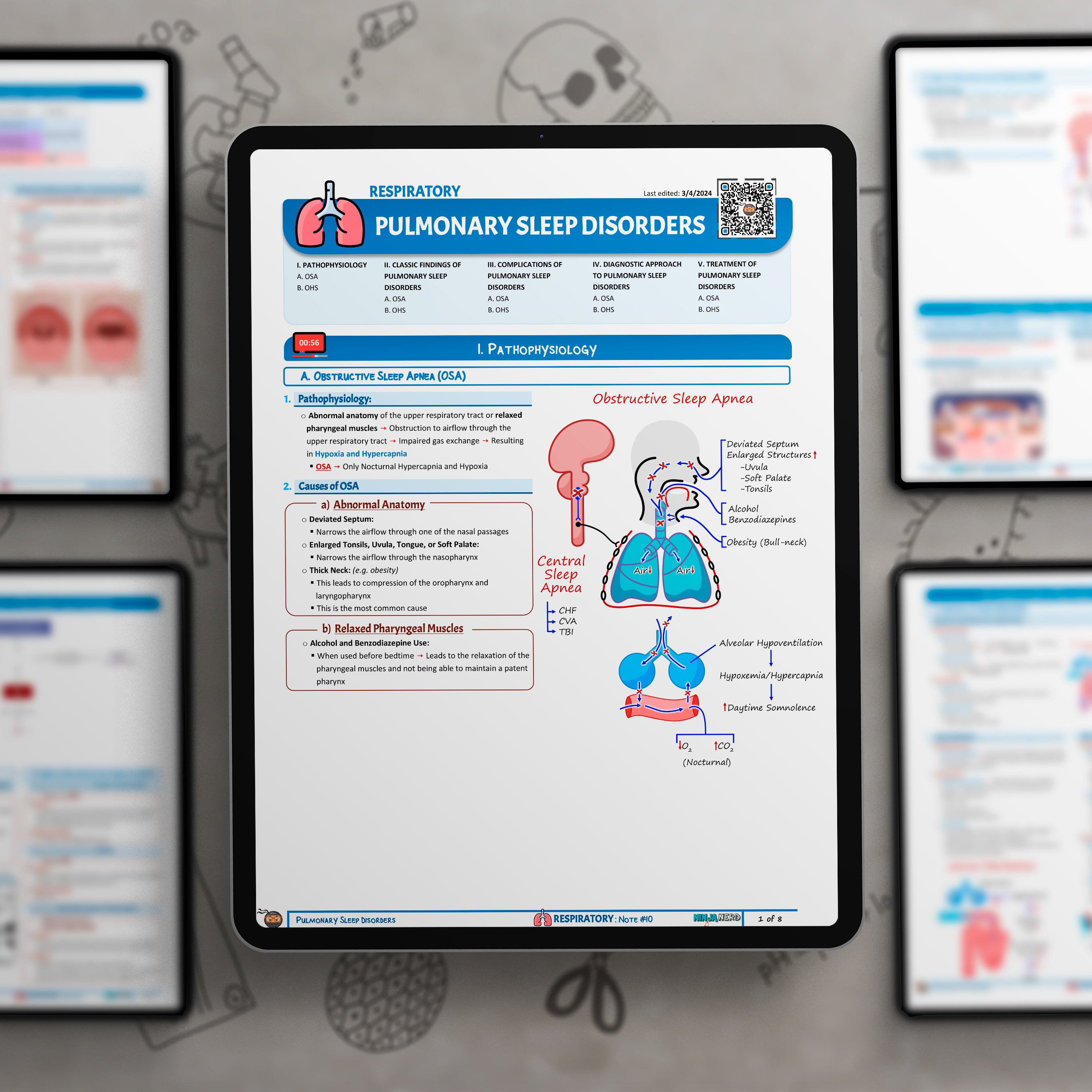 Pulmonary Sleep Disorders