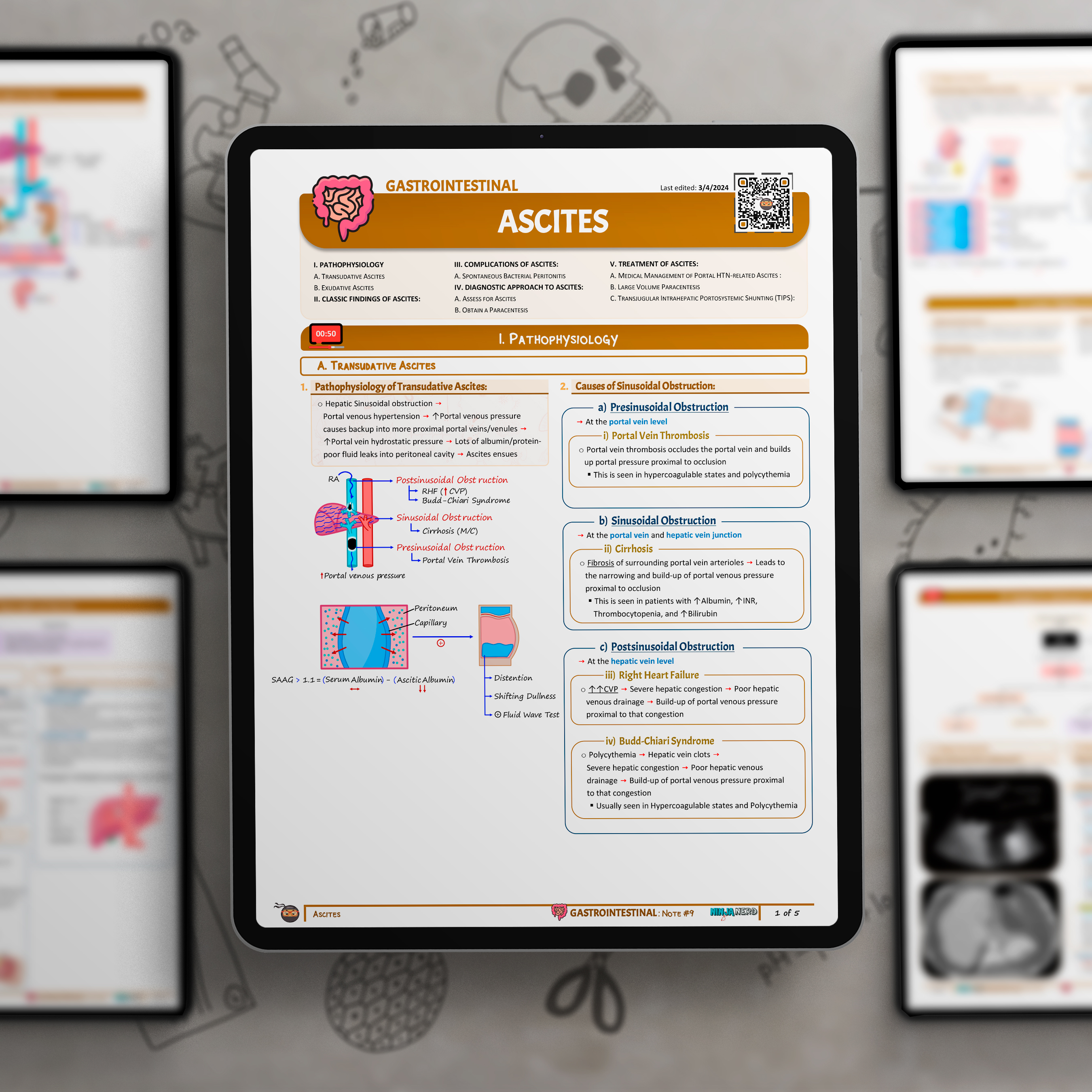 Ascites
