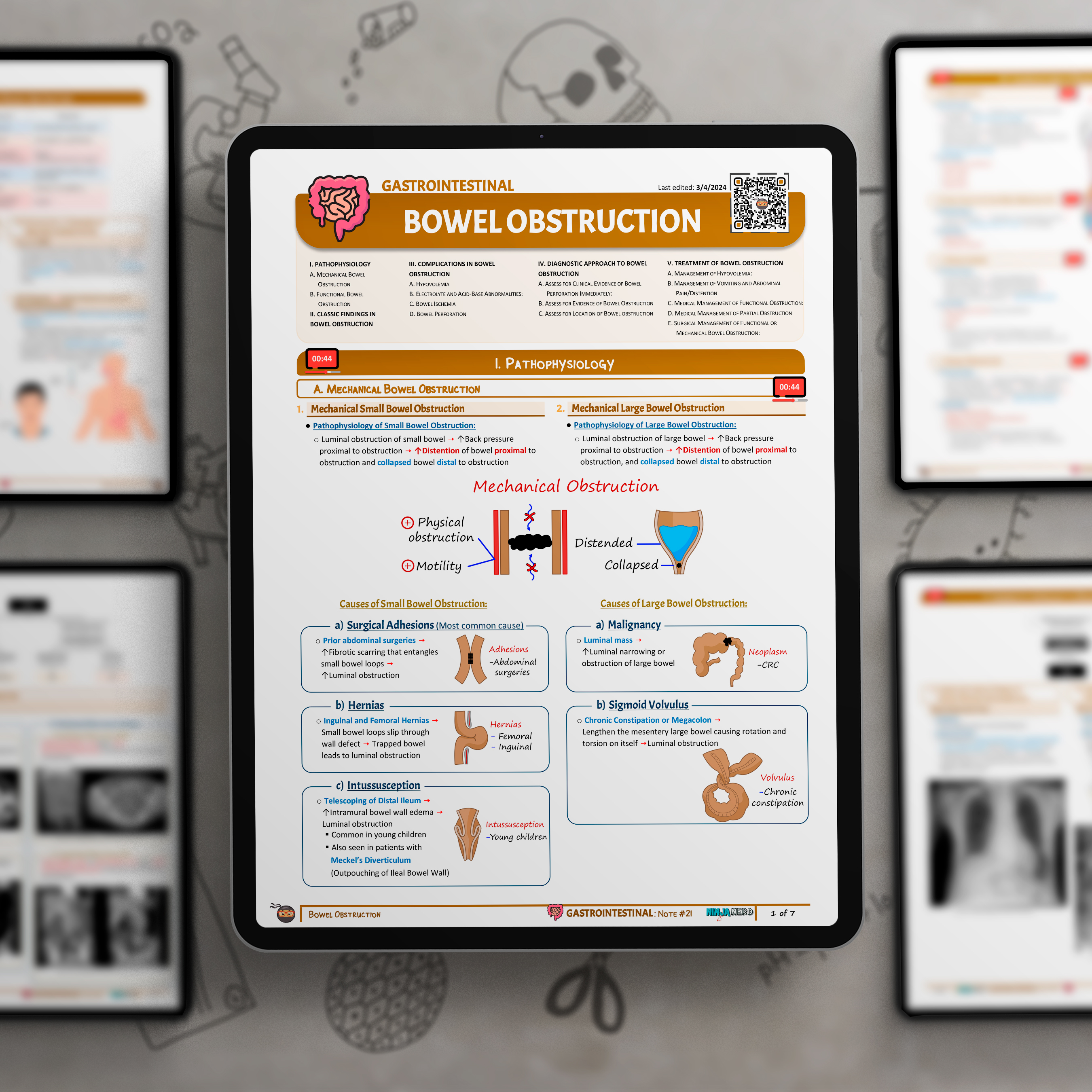 Bowel Obstruction