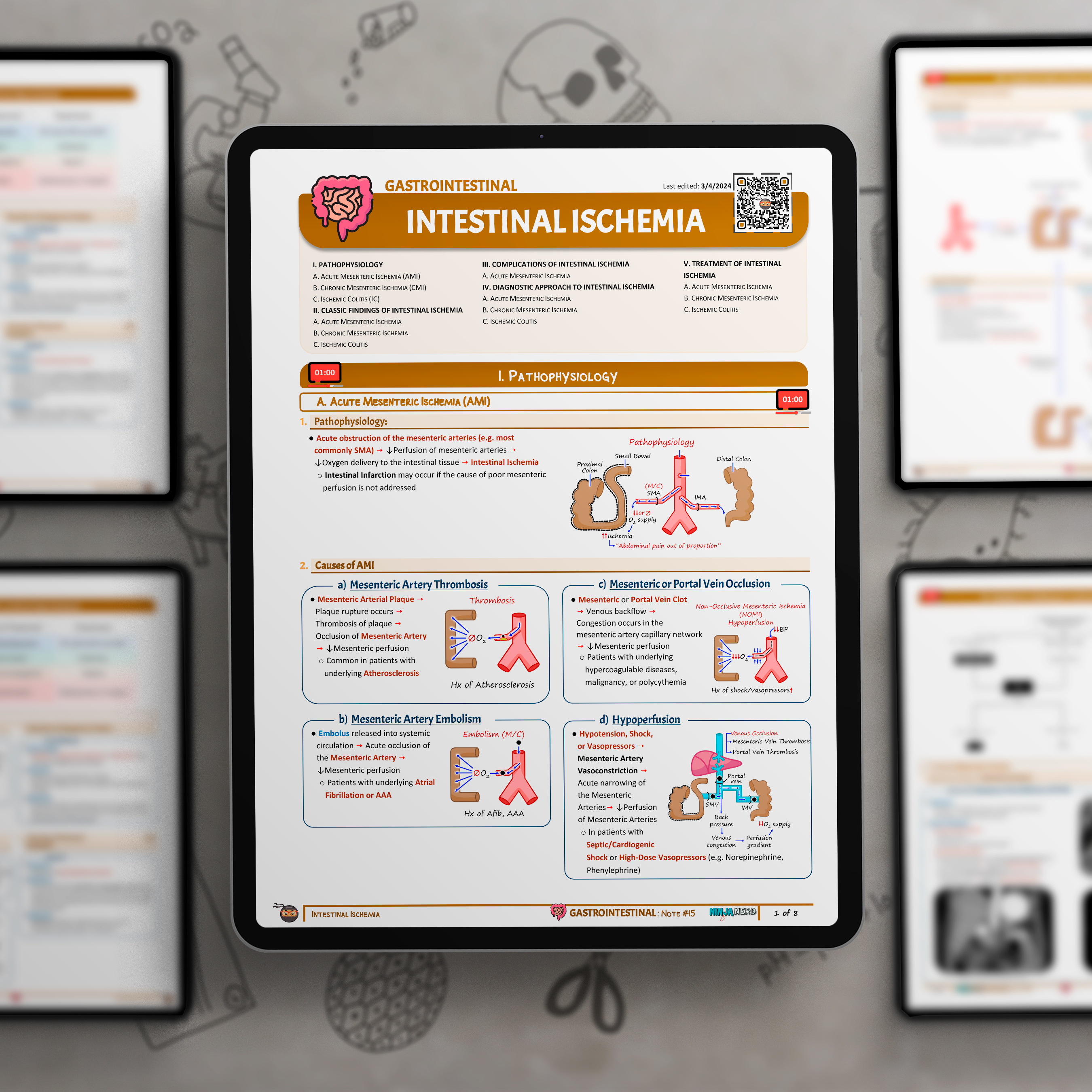 Intestinal Ischemia