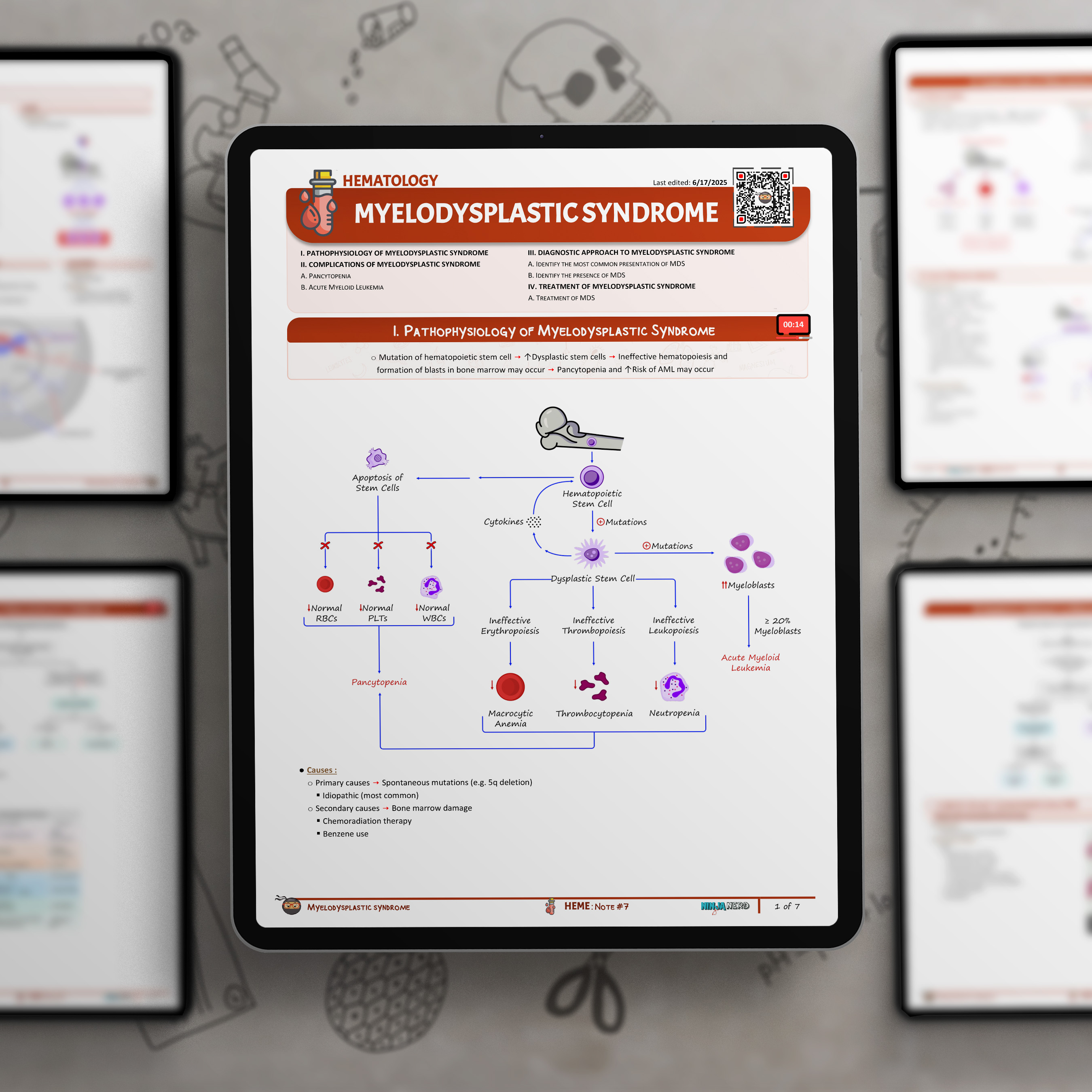 Myelodysplastic Syndrome (MDS)
