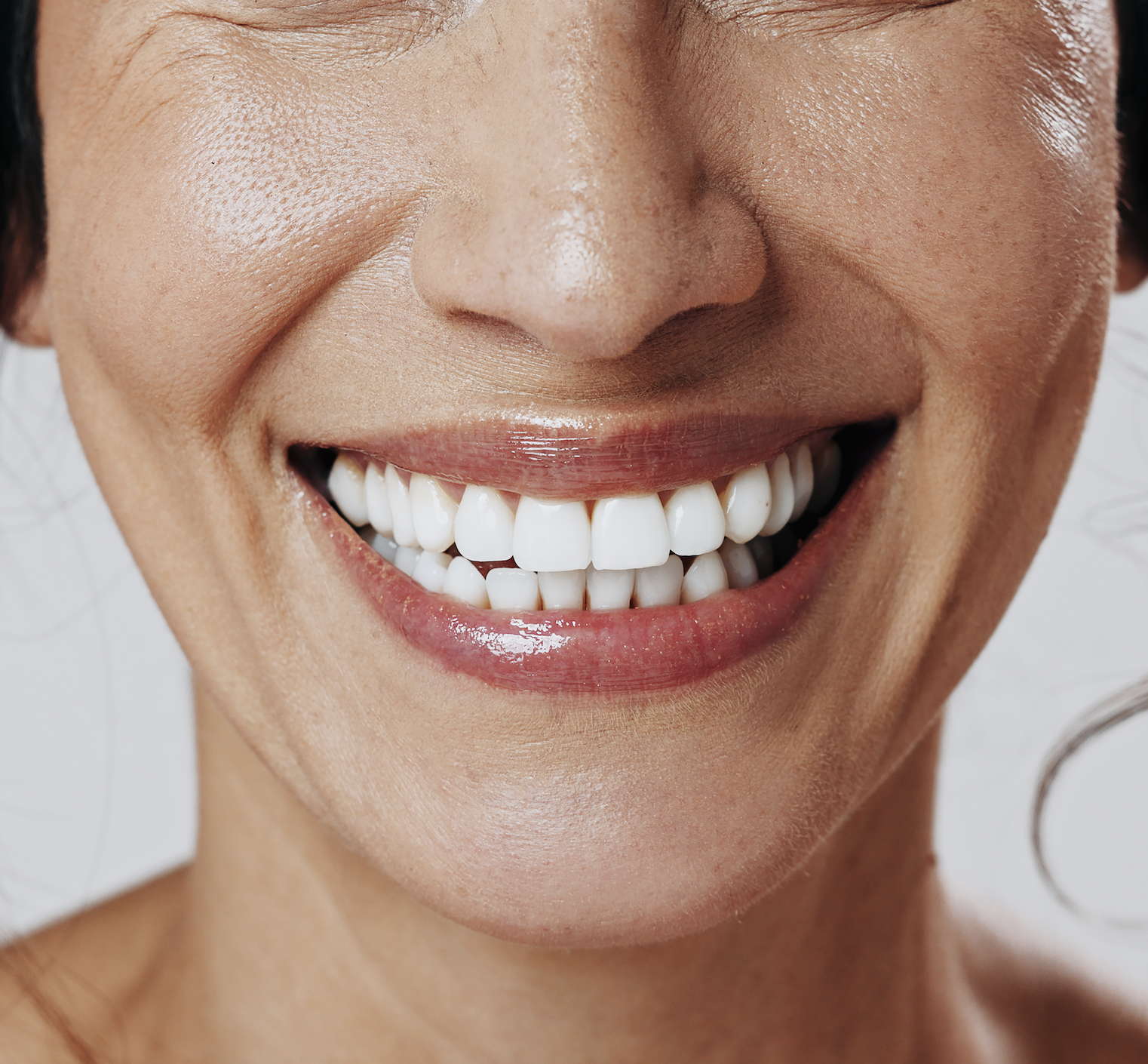 Why Choose Professional Teeth Whitening in Greenville?