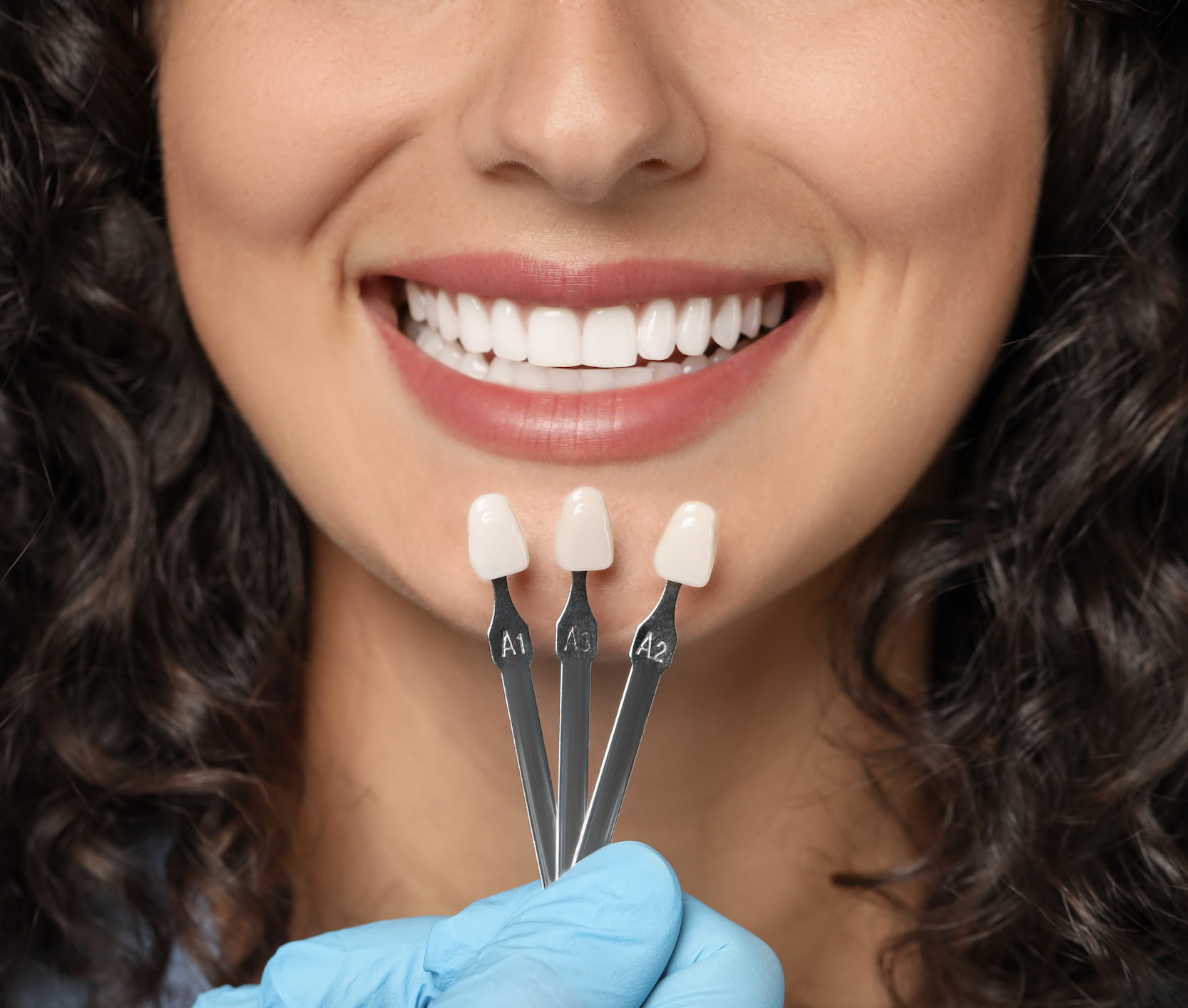 Your Guide to Choosing the Right Number of Veneers