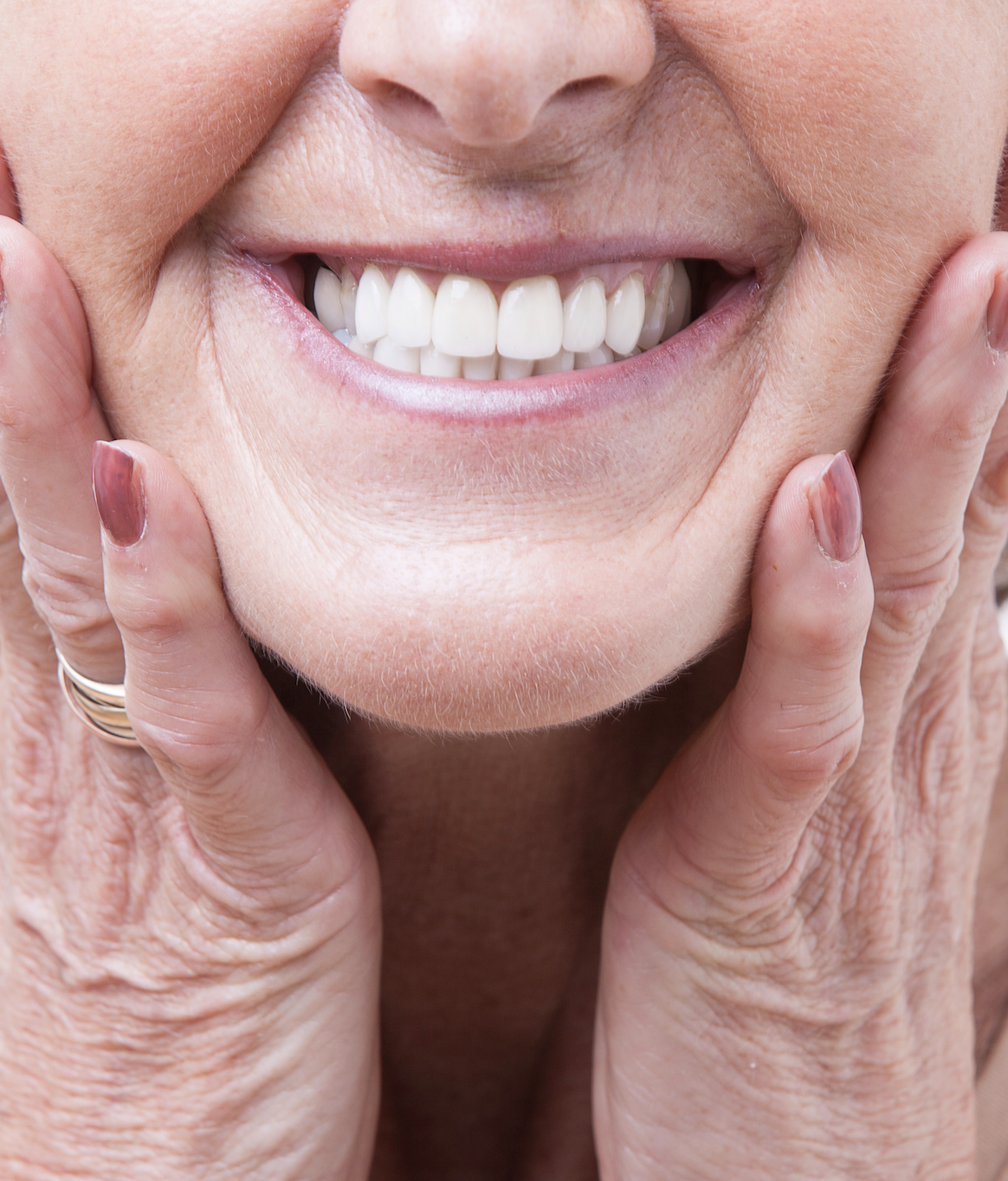 Keeping Your Dentures in Top Shape: What Every Wearer Should Know