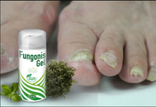 Fungonis Gel
