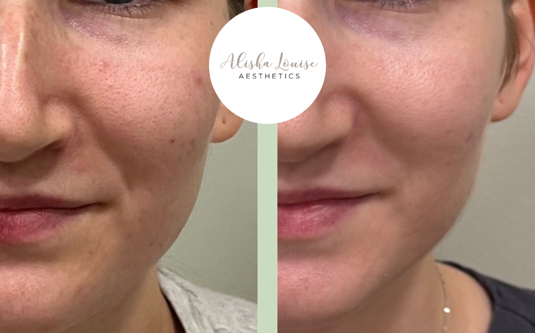 Why investing in medical-grade skincare like AlumierMD is essential for healthy, glowing skin in Liverpool…