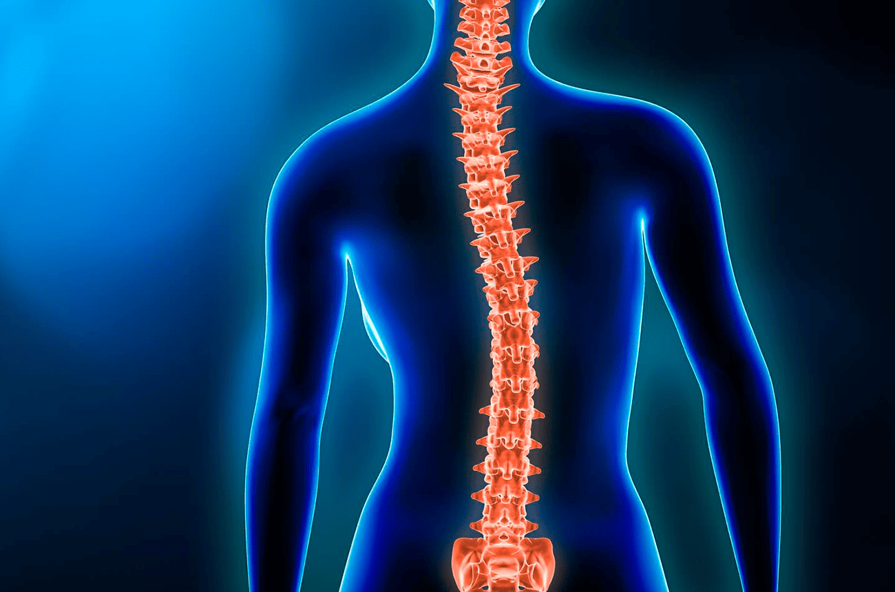 ¿Qué es la escoliosis?