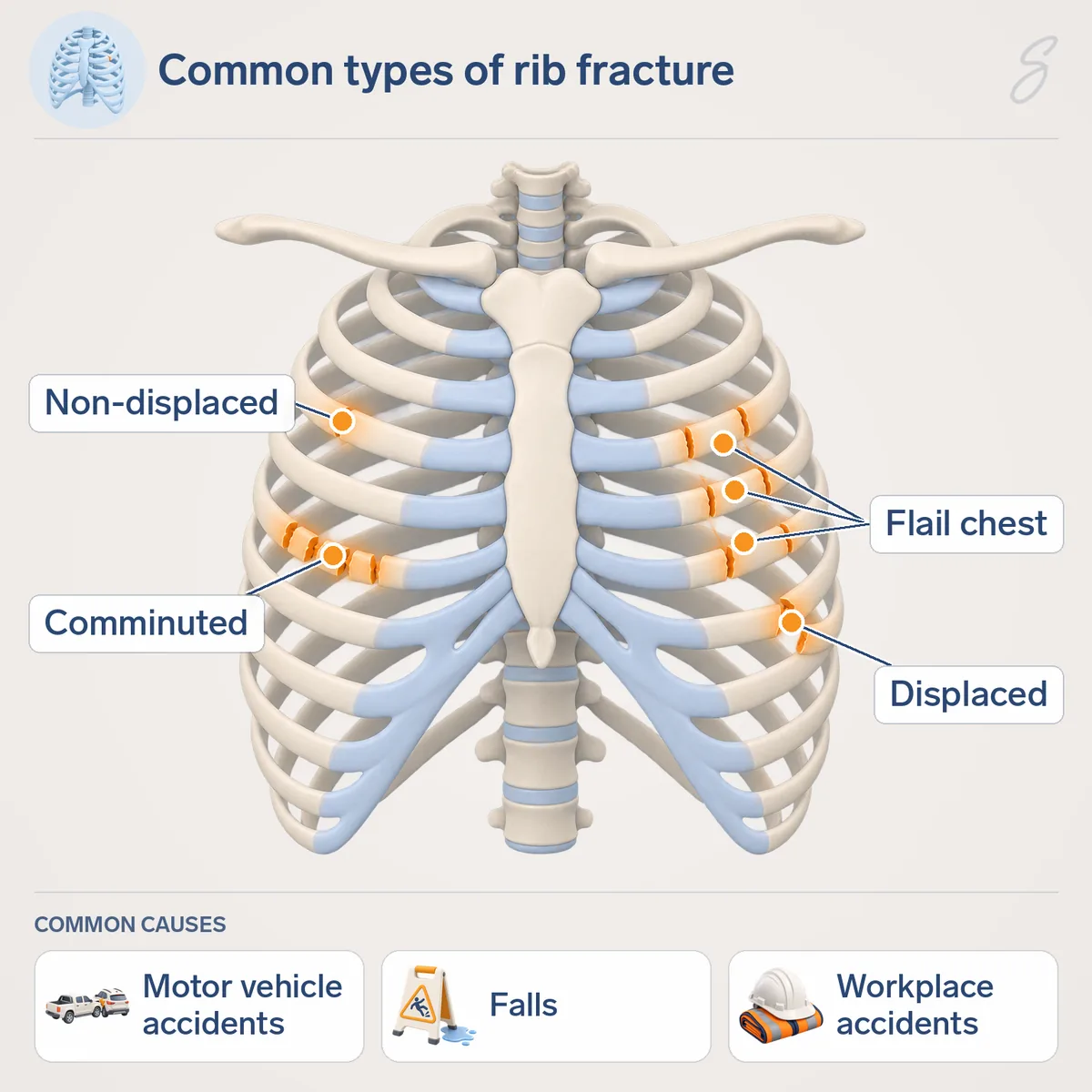 Diagram of the rib cage labelled with non-displaced, displaced and comminuted rib fractures and flail chest. Common causes shown are motor vehicle accidents, falls and workplace accidents.