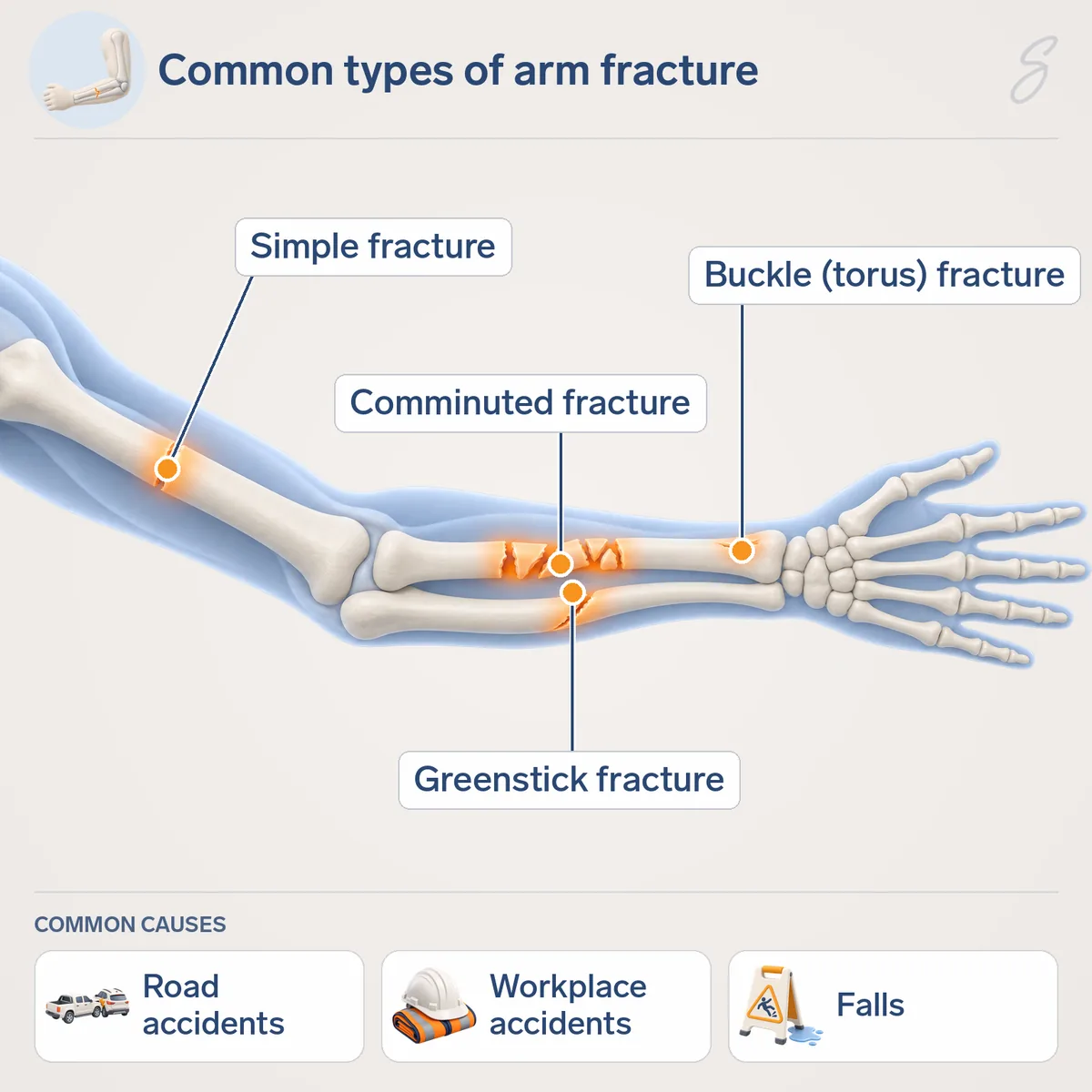 Diagram of the arm bones labelled with a simple fracture, a comminuted fracture, a buckle (torus) fracture and a greenstick fracture. Common causes shown are road accidents, workplace accidents and falls.