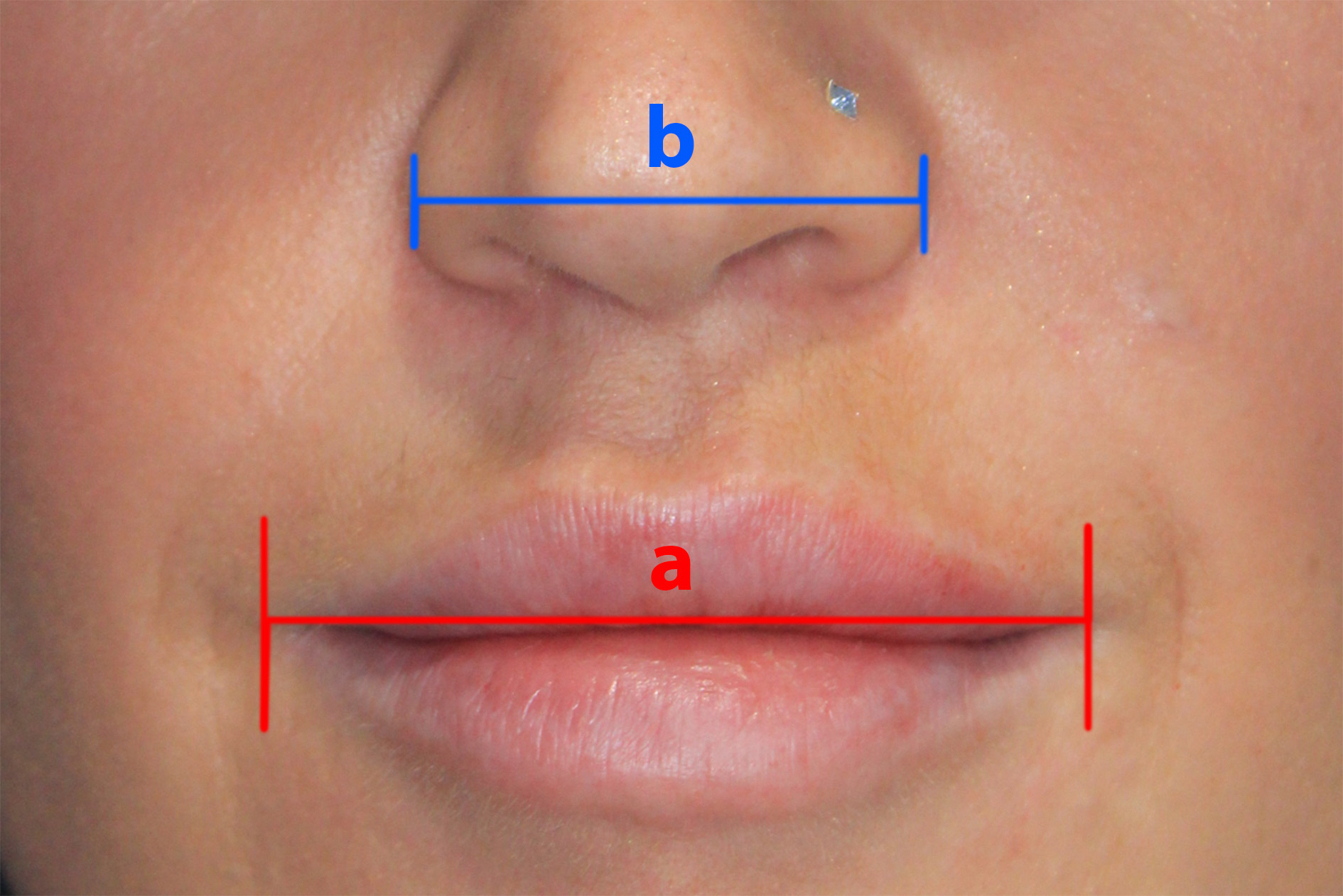 Facial symmetry diagram