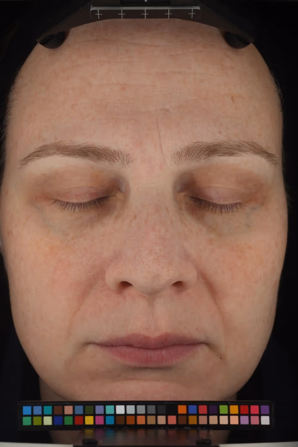 Redness Solution Complex