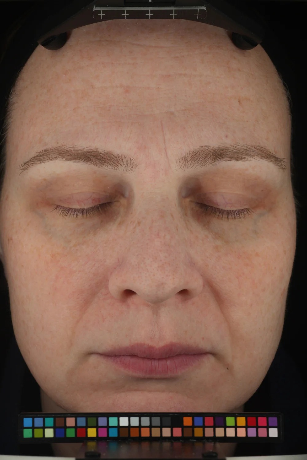 Redness Solution Complex