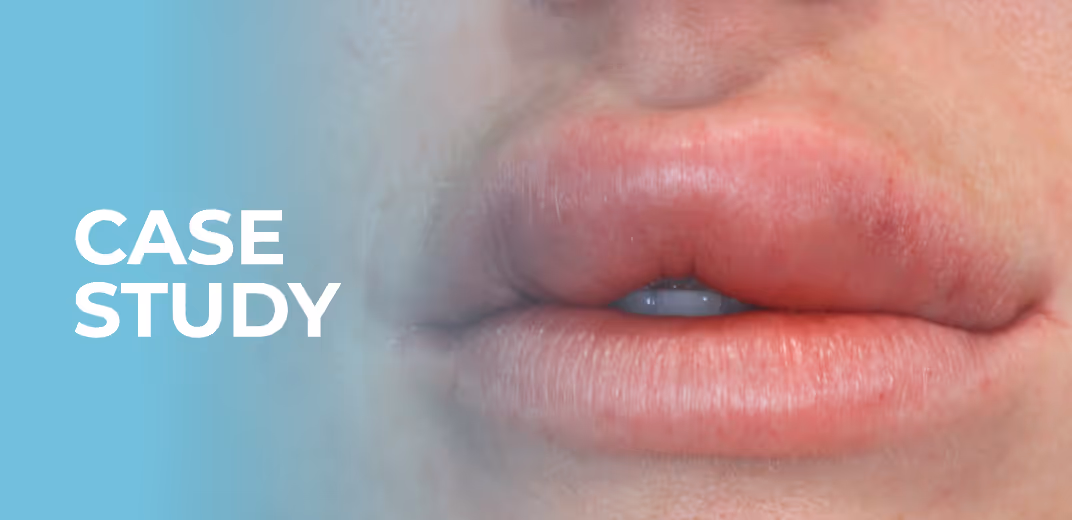 Case Study: Dealing with a Suspected Vascular Occlusion