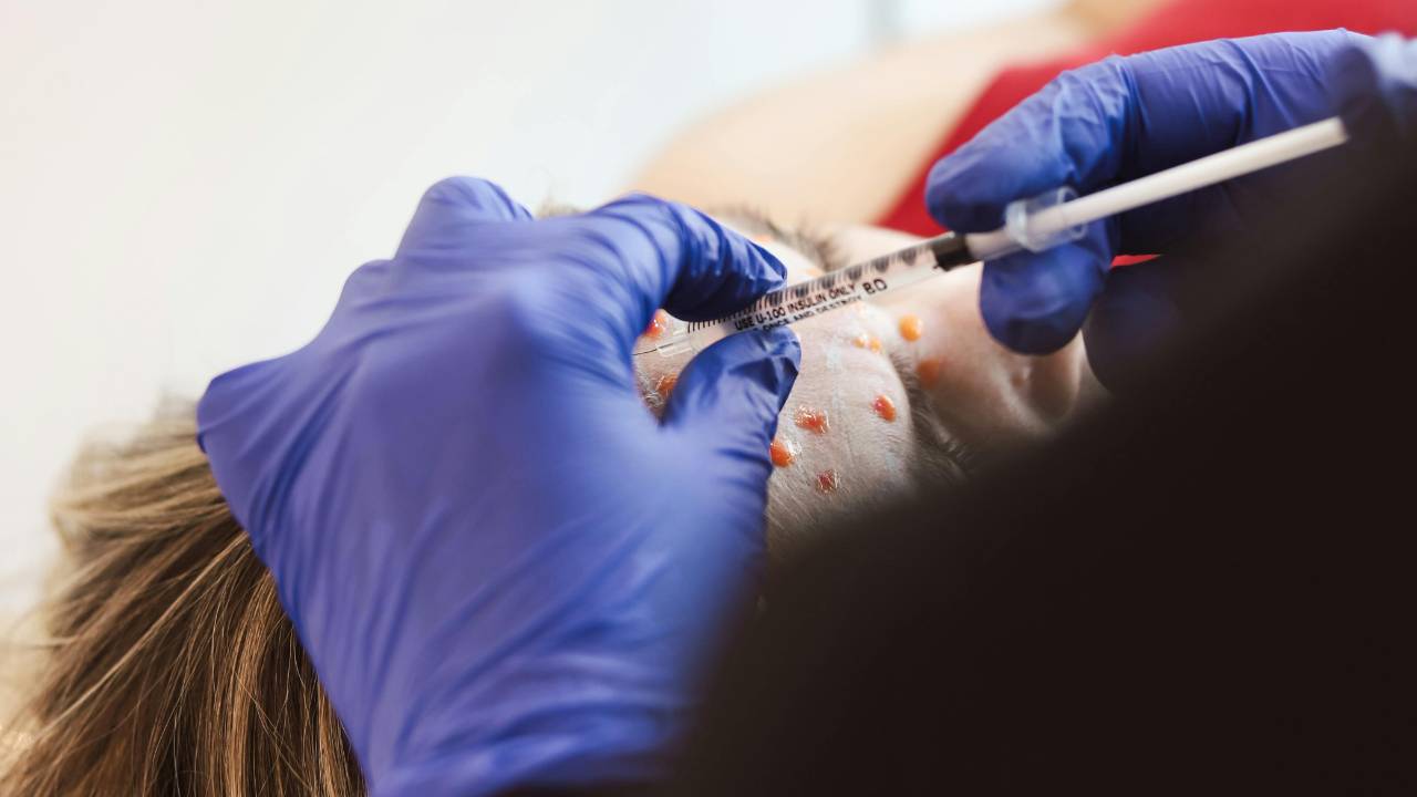 Picture of a woman getting Botox injections. 