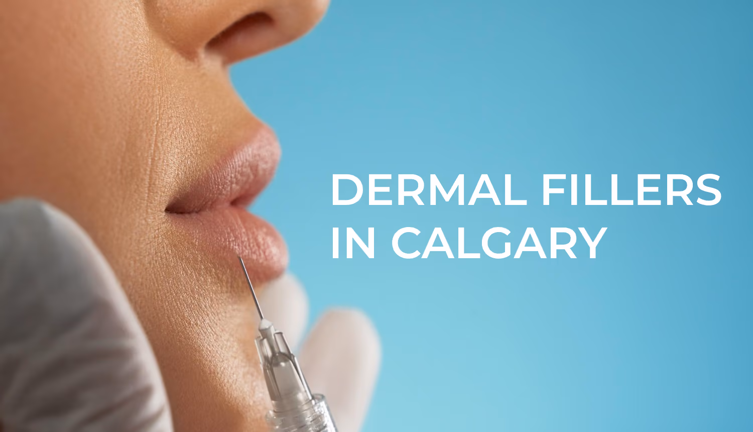 Dermal Fillers in Calgary: The Complete Guide to Types, Treatment Areas & Results
