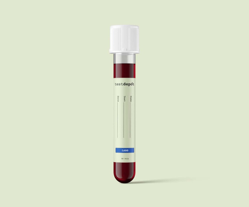 Blood labs