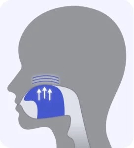 Myofunctional therapy