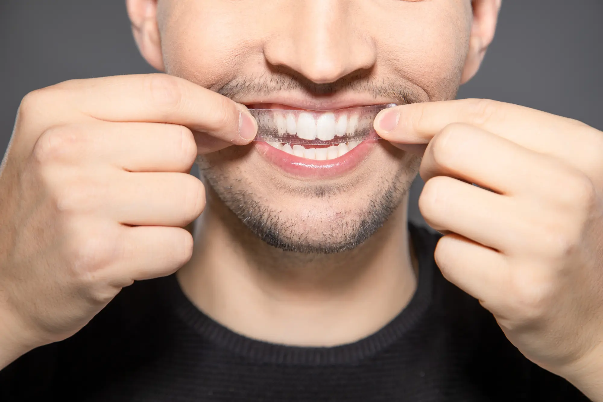What is the Most Natural-Looking Way to Whiten My Teeth?