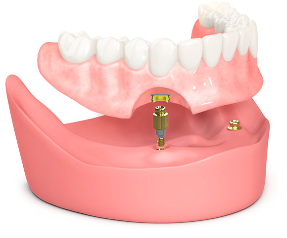 3D model of a teeth