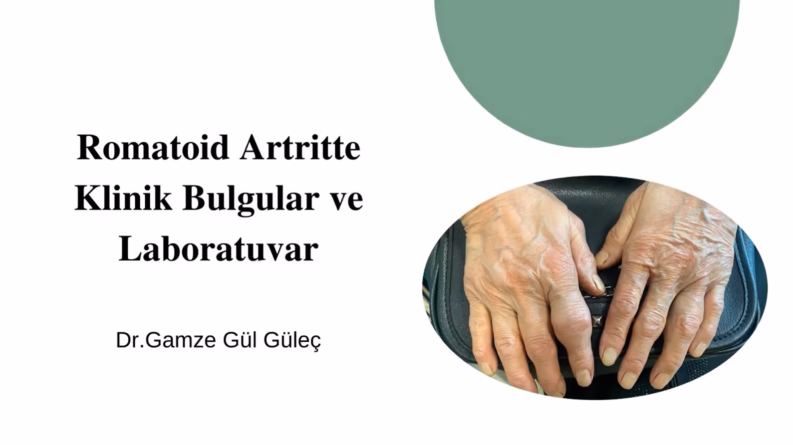 Romatoid Artritte Klinik Bulgular ve Laboratuvar