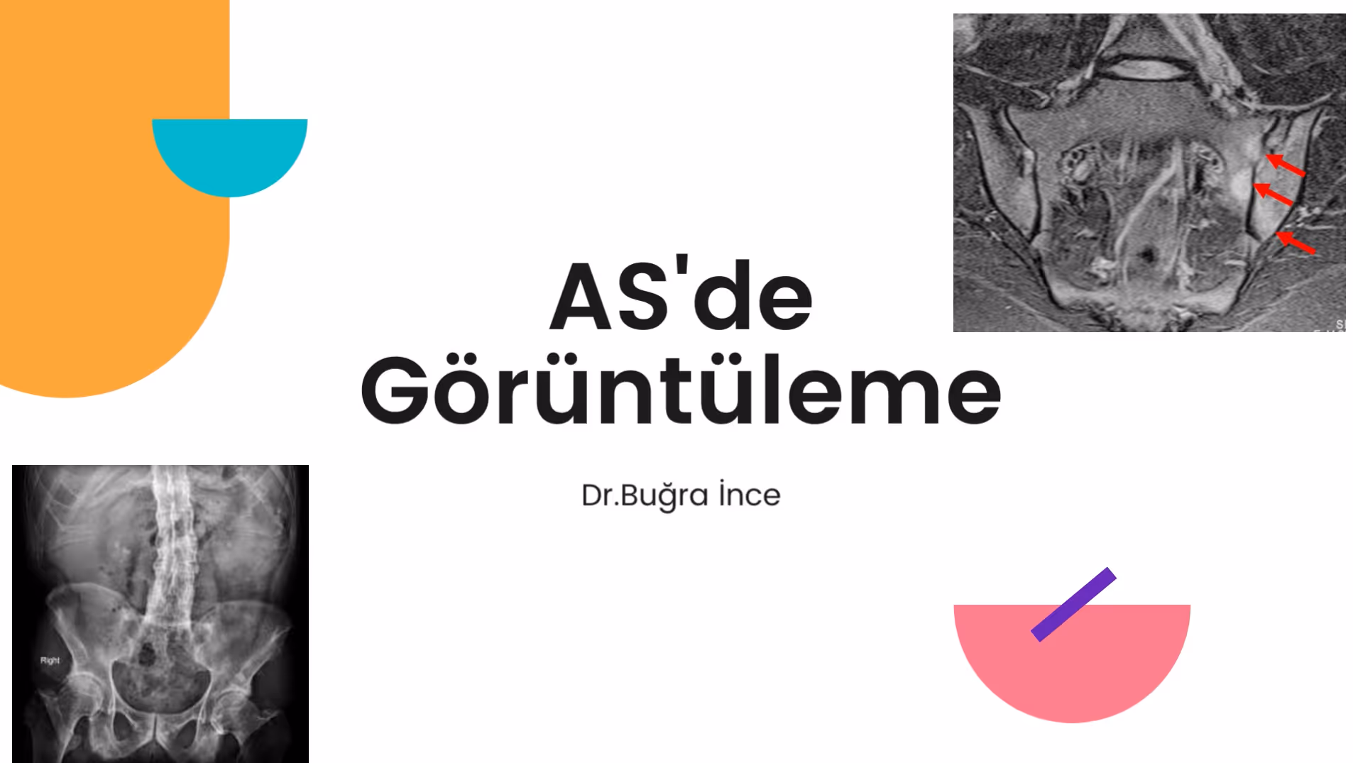 AS'de Görüntüleme