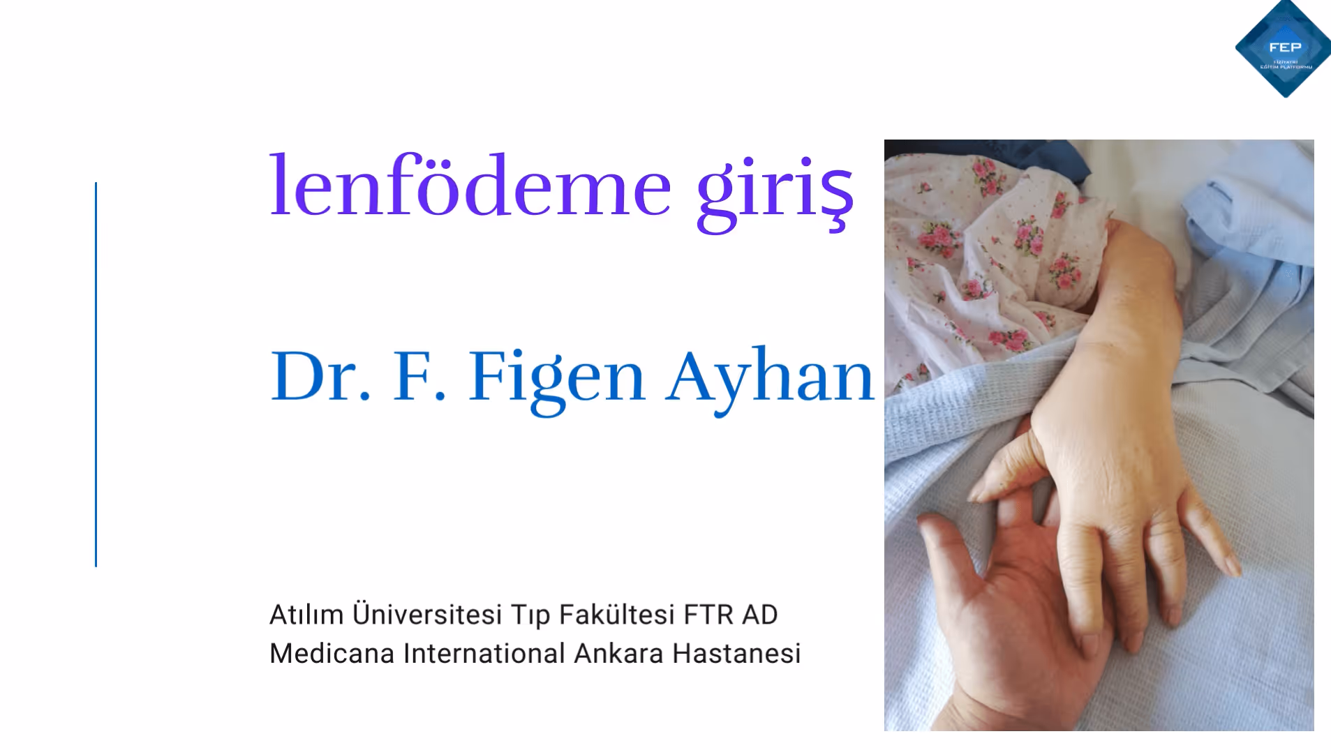 Lenfödeme Giriş