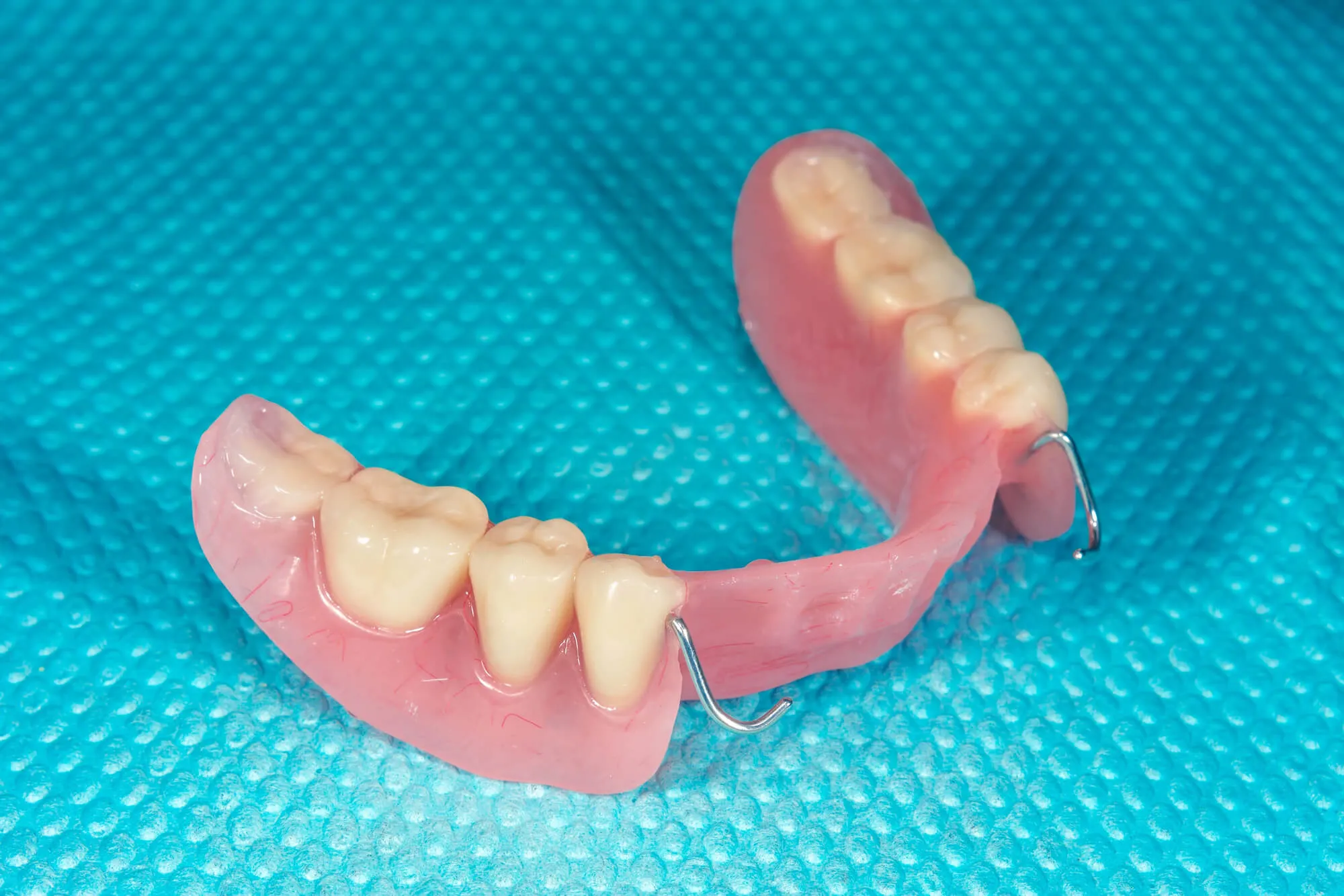partial dentures fort lauderdale