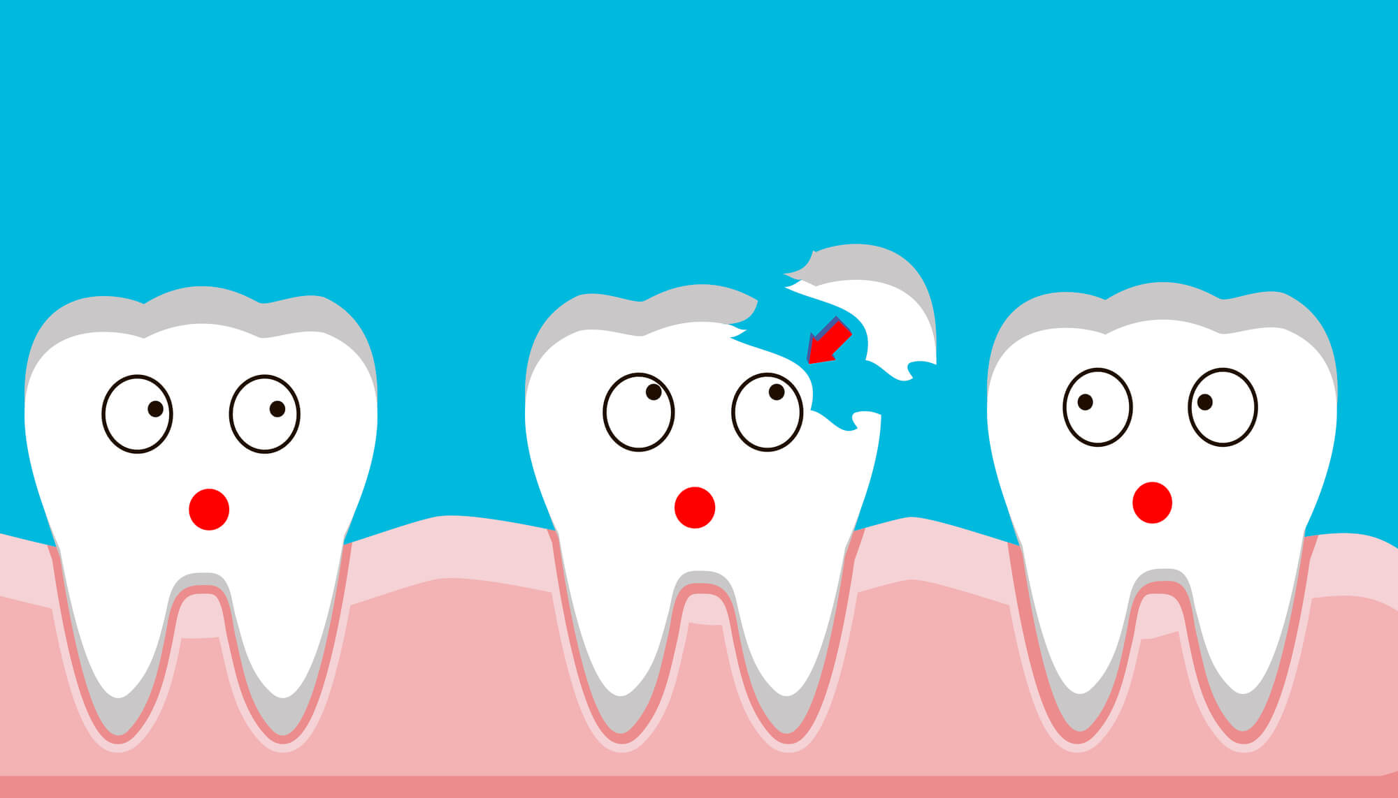 vector of cracked tooth at Dentist Fort Lauderdale