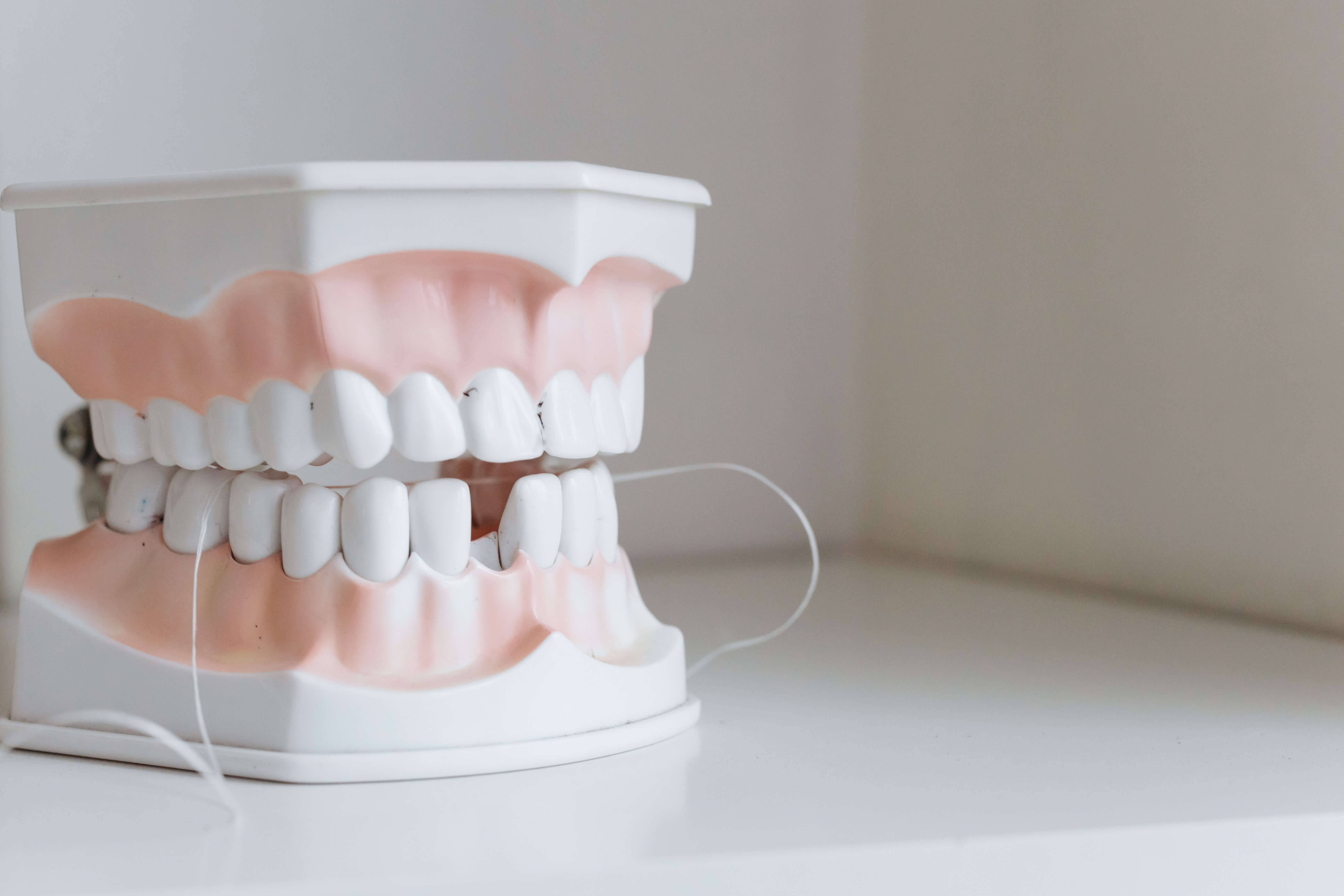 Model of Dentures in Fort Lauderdale 