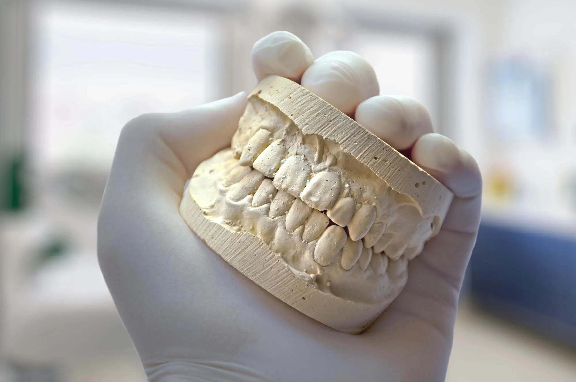 prosthodontist fort lauderdale holding a teeth model