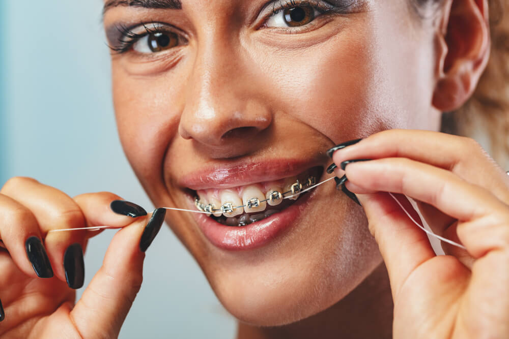 where is the best place to get braces 33304?
