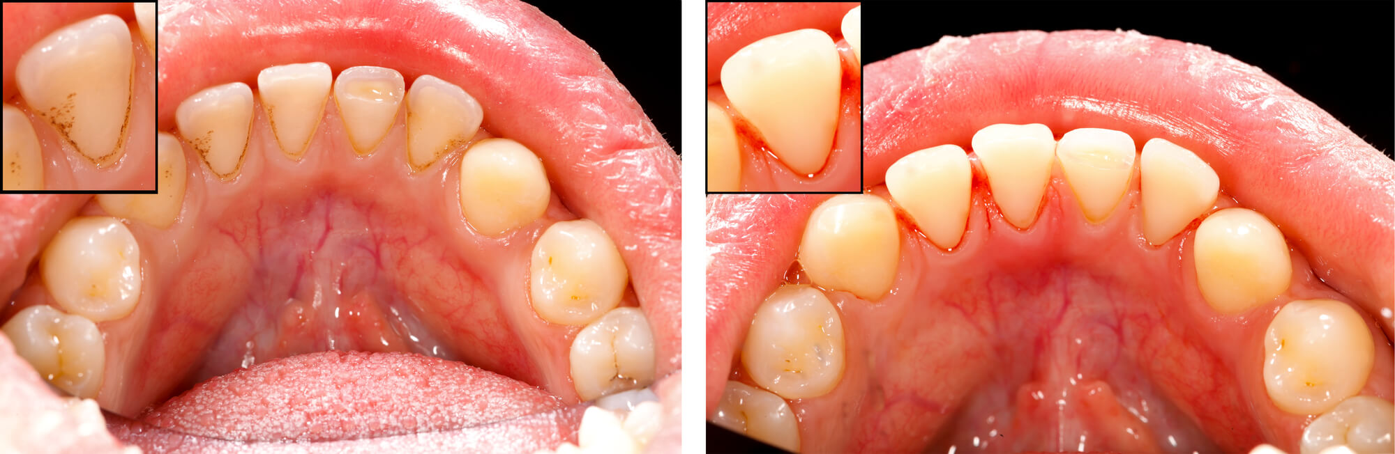 Who is the best Dentist Fort Lauderdale?
